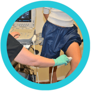 Sclerotherapy